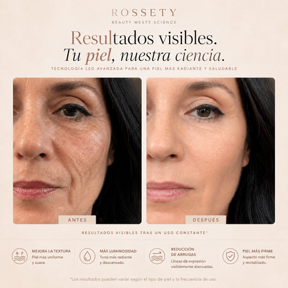 Rossety LumiMask™ | Máscara Antiedad fototerapia
