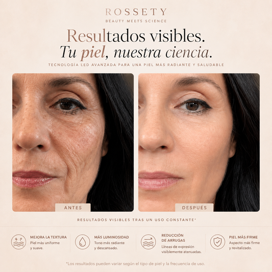 Rossety LumiMask™ | Máscara Antiedad fototerapia