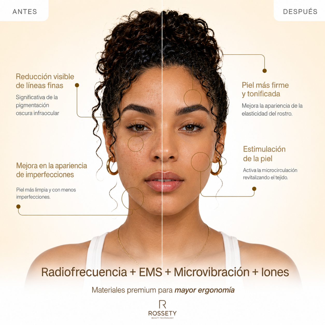 Rossety Face RF™ - Tratamiento Flacidez Facial